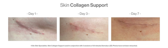 Skin Collagen Support client before and after results