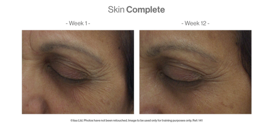 Skin Complete Client Before & After product results