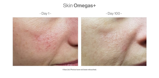 Skin Omegas+ client before and after photos