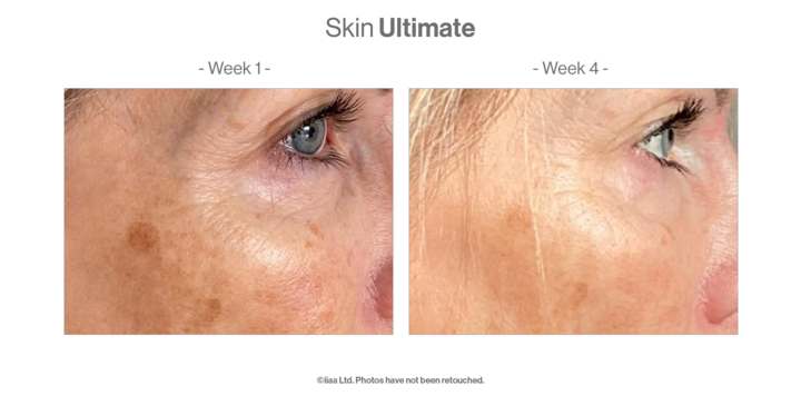 Skin Ultimate case study: before and after imagery